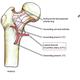 Illustration for article titled Could Modern Medicine Have Saved Bo Jacksons Career?
